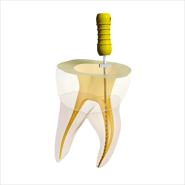 南浦和の小児歯科治療