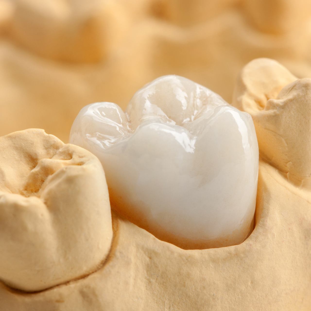 南浦和の審美歯科(白い詰め物・被せ物)