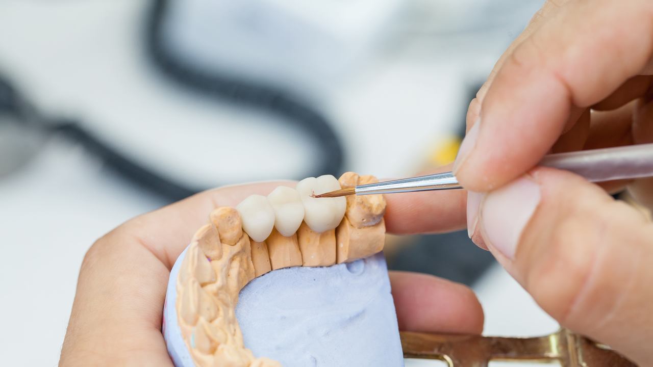 南浦和の審美歯科(白い詰め物・被せ物)