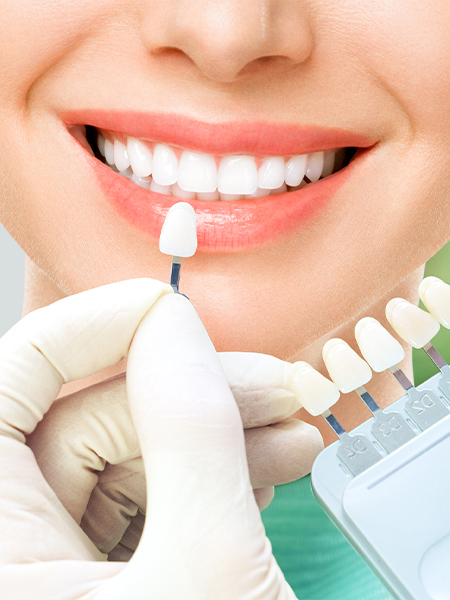 南浦和のホワイトニング