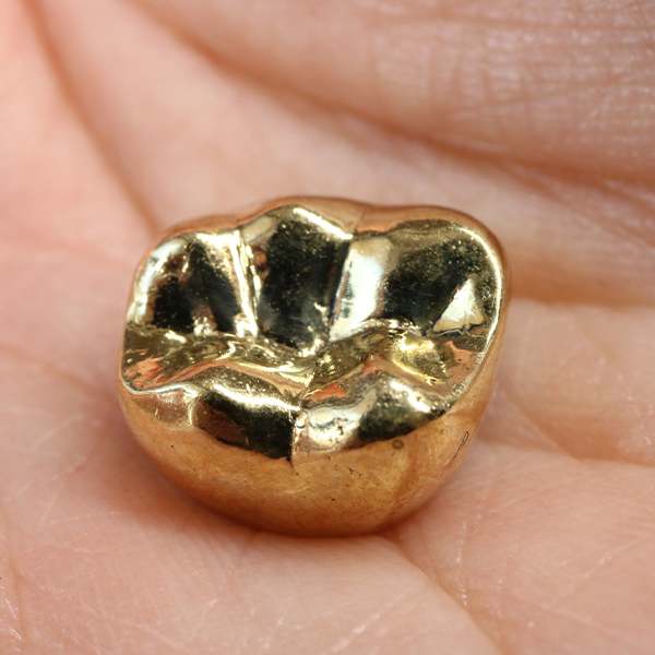 南浦和の審美歯科(白い詰め物・被せ物)