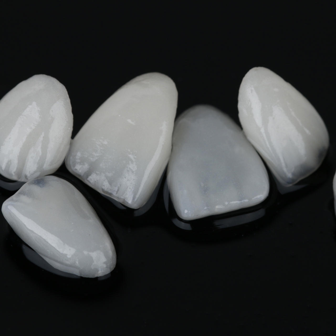 南浦和の審美歯科(白い詰め物・被せ物)