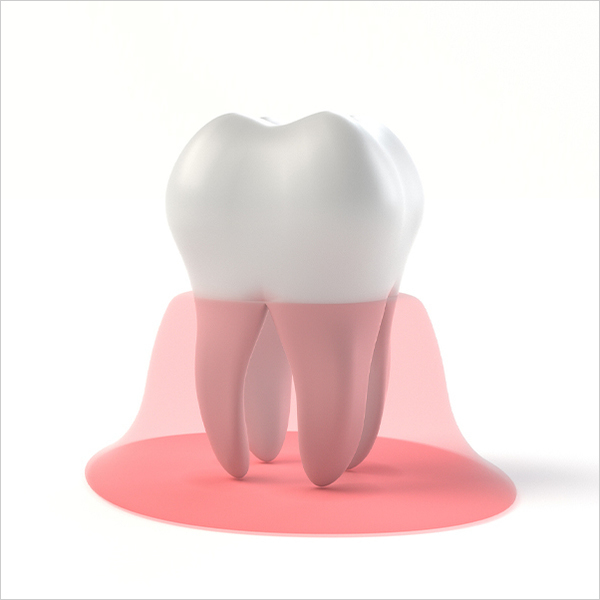 南浦和の歯周病治療