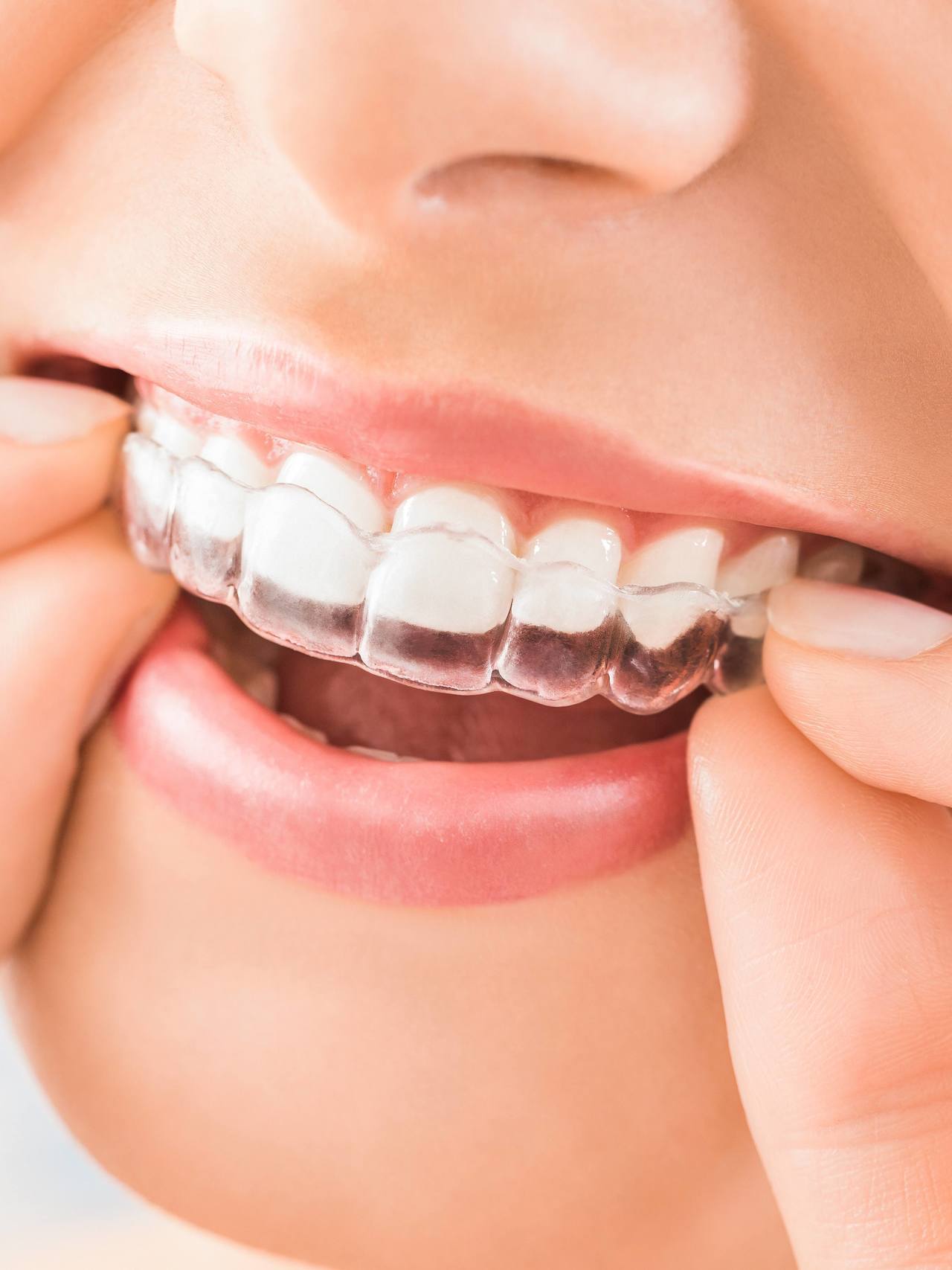 南浦和の矯正歯科治療