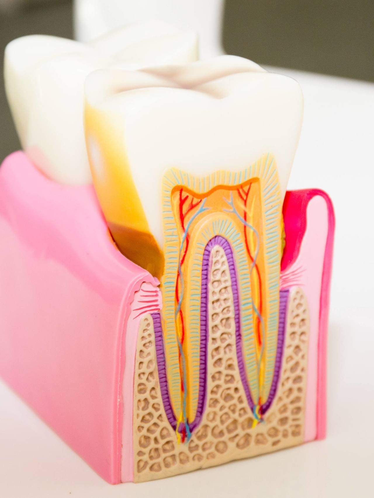 南浦和の歯周病治療